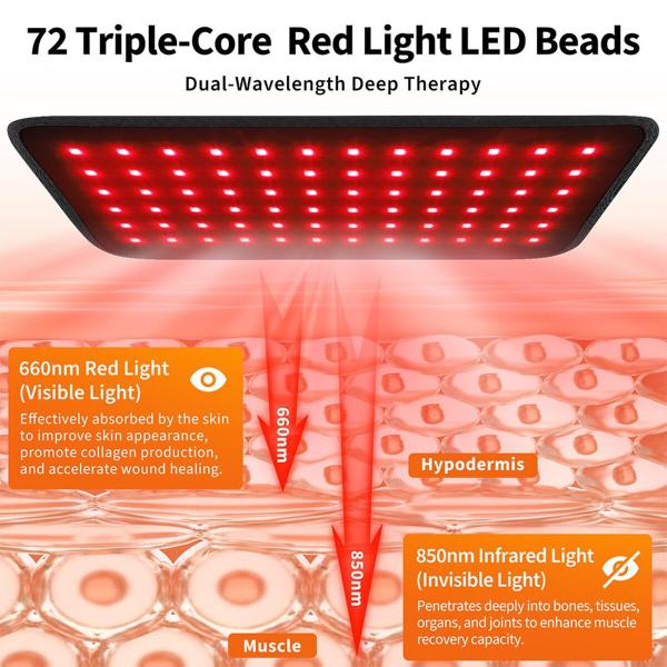 LED Red Light Therapy Belt — 72 LEDs, Cordless Heated Wrap