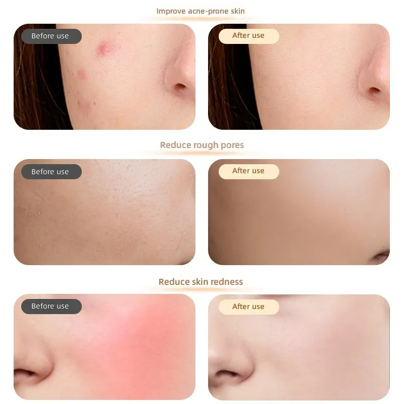 Wireless LED Face Mask — 7 Colors, Touch Control